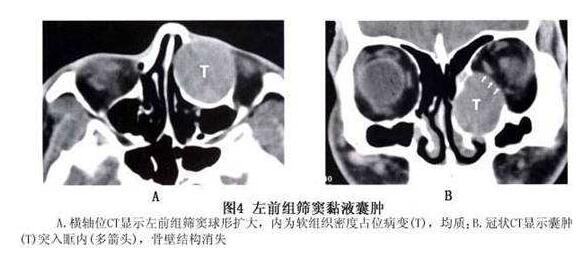 4月7-8日,天津医科大学眼科医院副院长、天津医科大学眼视光学院副院长、中华眼科学会委员、眼整形、眼眶病学组副组长孙丰源教授将莅临福州眼科医院2.jpg 4月7-8日,天津医科大学眼科医院副院长、天津医科大学眼视光学院副院长、中华眼科学会委员、眼整形、眼眶病学组副组长孙丰源教授将莅临福州眼科医院2.jpg
