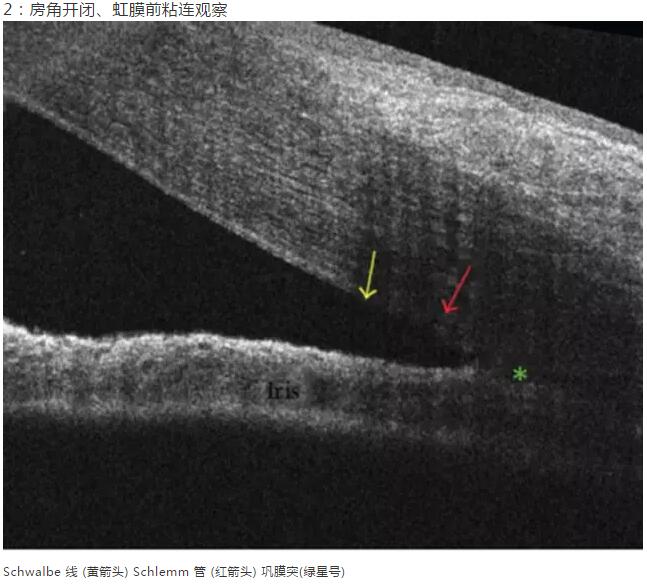 6686在线登录官网入口-6686(中国)课堂：后节频域OCT前节模块的运用12.jpg
