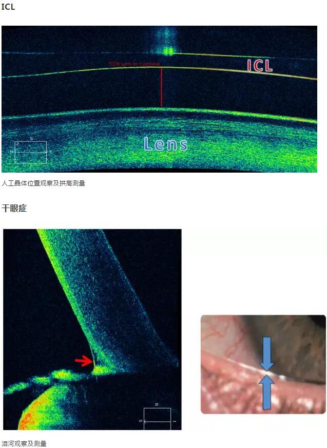 6686在线登录官网入口-6686(中国)课堂：后节频域OCT前节模块的运用15.jpg