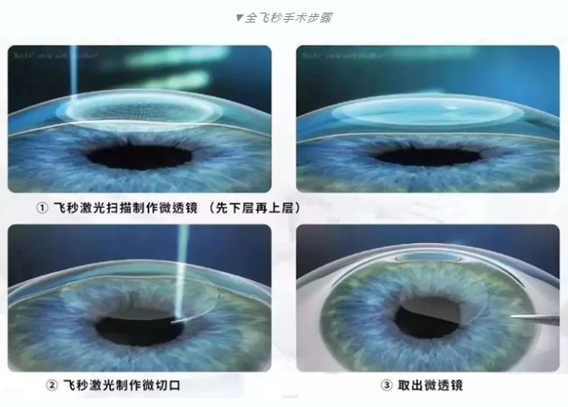 7月26日来深圳6686在线登录官网入口-6686(中国)参与暑期摘镜季活动就可以有机会参与抽奖免单手术！2.png