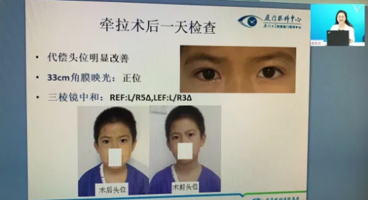 高峰论道·云端荟萃 ▏万人同步在线，30余名大咖云集“第六届6686在线登录官网入口-6686(中国)论坛斜视与小儿眼科新技术学习班暨小儿、眼视光分论坛”7.png